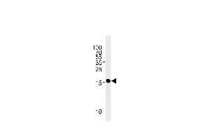 GMFG Antibody (N-term) ABIN1882247 western blot analysis in Jurkat cell line lysates (35 μg/lane). (GMFG 抗体)