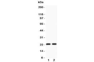 Western blot testing of CD3 epsilon antibody and Lane 1:  Jurkat (CD3 epsilon 抗体  (AA 23-207))