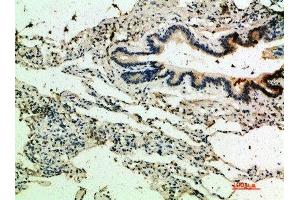 Immunohistochemical analysis of paraffin-embedded human-lung, antibody was diluted at 1:200 (THBS4 抗体  (AA 551-600))