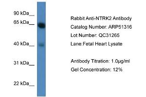 WB Suggested Anti-NTRK2  Antibody Titration: 0. (TRKB 抗体  (C-Term))
