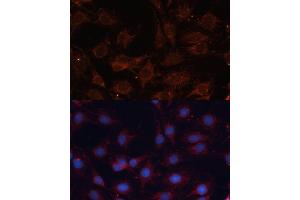 Immunofluorescence analysis of C6 cells using SLC25 antibody (ABIN6132661, ABIN6147921, ABIN6147922 and ABIN6215721) at dilution of 1:100. (SLC25A24 抗体  (AA 1-200))