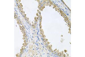 Immunohistochemistry of paraffin-embedded human prostate using HSP90AA1 antibody (ABIN6292998) at dilution of 1:100 (40x lens). (HSP90AA1 抗体)