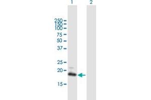 Western Blot analysis of GUCA1C expression in transfected 293T cell line by GUCA1C MaxPab polyclonal antibody. (GUCA1C 抗体  (AA 1-209))