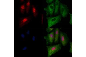 ABIN6263779 and ABIN6279623 staining  cells by IF/ICC. (NUP88 抗体  (Internal Region))