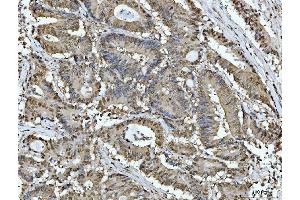 IHC analysis of ACLY using anti-ACLY antibody (ABIN4886416). (ACLY 抗体  (AA 1-180))