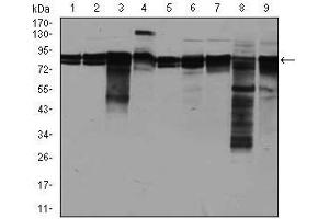 Western blot analysis using EIF4B mouse mAb against A549 (1), A431 (2), HepG2 (3), HEK293 (4), HeLa (5), Jurkat (6), K562 (7), NIH3T3 (8), and MCF-7 (9) cell lysate. (EIF4B 抗体)