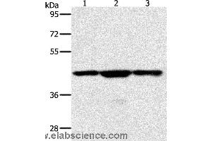 Western blot analysis of Jurkat, hela and K562 cell, using MAP2K1 Polyclonal Antibody at dilution of 1:400 (MEK1 抗体)