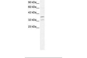 Image no. 1 for anti-Forkhead Box L1 (FOXL1) (N-Term) antibody (ABIN202292) (FOXL1 抗体  (N-Term))