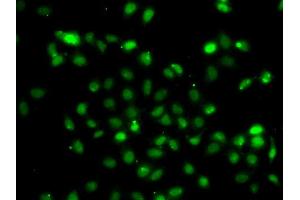 Immunofluorescence analysis of A549 cell using BCL6 antibody. (BCL6 抗体)
