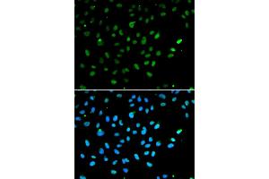 Immunofluorescence analysis of A549 cells using SMARCA4 antibody. (SMARCA4 抗体)