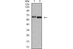 Western blot analysis using VP2 mouse mAb against A431 (1) and BCBL-1 (2) cell lysate. (VP2 (AA 296-438) 抗体)