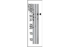 The anti-Importin alpha-3 Pab (ABIN388688 and ABIN2838720) is used in Western blot to detect Importin alpha-3 in Hela (left), mouse brain (middle), and HepG2 (right)cell line/tissue lysates. (KPNA4 抗体  (C-Term))