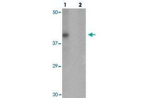 Western blot analysis of RNASET2 in SW480 cell lysate with RNASET2 polyclonal antibody  at 1 ug/mL in (lane 1) the absence and (lane 2) the presence of blocking peptide. (RNASET2 抗体  (C-Term))