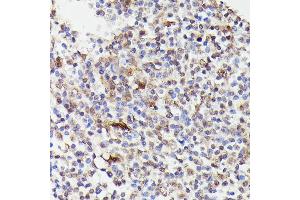 Immunohistochemistry of paraffin-embedded human tonsil using CDC23 antibody (ABIN7266248) at dilution of 1:100 (40x lens).