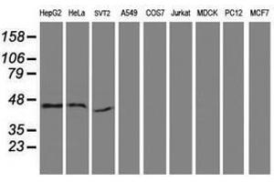 Image no. 2 for anti-serpin Peptidase Inhibitor, Clade B (Ovalbumin), Member 13 (SERPINB13) antibody (ABIN1500879) (SERPINB13 抗体)