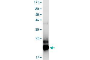 Image no. 2 for Tumor Necrosis Factor Receptor Superfamily, Member 10b (TNFRSF10B) (AA 56-180) protein (His-DYKDDDDK-Strep II Tag) (ABIN3071468)