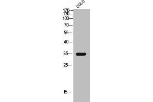 Western Blot analysis of COLO cells using GPR119 Polyclonal Antibody (G Protein-Coupled Receptor 119 抗体  (Internal Region))