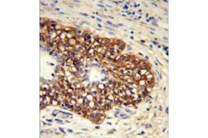 Immunohistochemistry (Paraffin-embedded Sections) (IHC (p)) image for anti-Prostaglandin I2 (Prostacyclin) Synthase (PTGIS) (C-Term) antibody (ABIN453611)