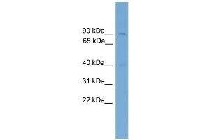 WB Suggested Anti-Aste1 Antibody Titration:  0. (ASTE1 抗体  (Middle Region))