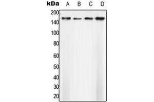 Western blot analysis of SAP155 expression in A431 (A), Ramos (B), SP2/0 (C), H9C2 (D) whole cell lysates. (SF3B1 抗体  (N-Term))