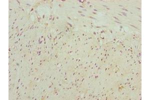 Immunohistochemistry of paraffin-embedded human colon tissue using ABIN7161250 at dilution of 1:100 (NBPF3 抗体  (AA 1-252))