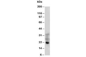 Western blot testing of FGF4 antibody and HeLa cell lysate (FGF4 抗体)