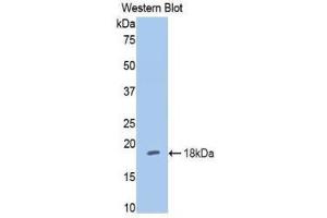 Western Blotting (WB) image for anti-Hexokinase 1 (HK1) (AA 676-800) antibody (ABIN1859173)
