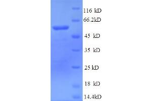 SDS-PAGE (SDS) image for Muscle, Skeletal, Receptor Tyrosine Kinase (MUSK) (AA 24-495), (Cytoplasmic Domain), (Cytosolic) protein (His tag) (ABIN5713682)