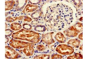Immunohistochemistry of paraffin-embedded human kidney tissue using ABIN7152544 at dilution of 1:100 (FANCC 抗体  (AA 1-210))