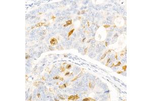 Immunohistochemistry (IHC) image for anti-Chromosome 6 Open Reading Frame 150 (C6orf150) (AA 350-522) antibody (ABIN6143590)