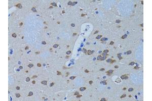 Immunohistochemistry of paraffin-embedded rat brain using PLCB1 antibody (ABIN1874160) at dilution of 1:100 (40x lens). (Phospholipase C beta 1 抗体)