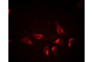Immunofluorescent analysis of BCLG staining in Hela cells. (BCL2L14 抗体)