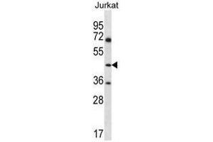ASS1 Antibody (C-term) western blot analysis in Jurkat cell line lysates (35µg/lane). (ASS1 抗体  (C-Term))