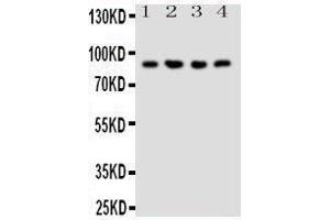 Western Blotting (WB) image for anti-Neuregulin 2 (NRG2) (AA 289-306), (Middle Region) antibody (ABIN3044233) (Neuregulin 2 抗体  (Middle Region))