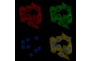 RSPH4A Mouse Monoclonal Antibody staining Hela cells by IF/ICC.