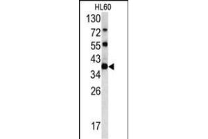 Western Blotting (WB) image for anti-Chloride Channel, Nucleotide-Sensitive, 1A (CLNS1A) (AA 189-216), (C-Term) antibody (ABIN390419)