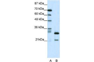 WB Suggested Anti-HMOX2 Antibody Titration: 0. (HMOX2 抗体  (N-Term))