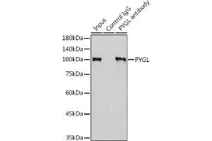 Immunoprecipitation (IP) image for anti-phosphorylase, Glycogen, Liver (PYGL) (AA 1-280) antibody (ABIN6146525)