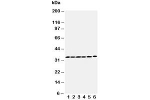 Western blot testing of Cyclin D1 antibody and Lane 1:  rat testis