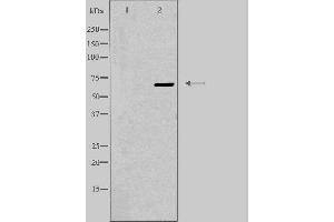 Western blot analysis of extracts from K562 cells, using EPN3 antibody. (EPN3 抗体  (Internal Region))