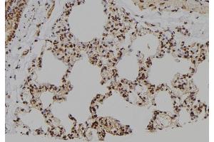 ABIN6260477 and ABIN6276706 at 1/100 staining Rat lung tissue by IHC-P.