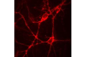 Indirect immunolabeling of PFA fixed rat hippocampus neurons. (Tenascin R 抗体)