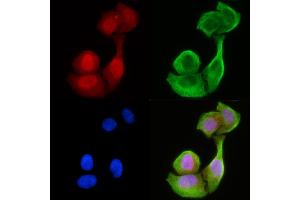 staining Hela cells(30 min of UV treatment) by IF/ICC. (CCDC99 抗体  (C-Term))