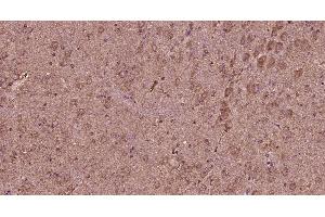Paraformaldehyde-fixed, paraffin embedded rat brain, Antigen retrieval by boiling in sodium citrate buffer (pH6) for 15min, Block endogenous peroxidase by 3% hydrogen peroxide for 30 minutes, Blocking buffer (normal goat serum) at 37°C for 20min, Antibody incubation with Progestin Receptor Beta/MPRB Antibody at 1:400 overnight at 4°C, followed by a conjugated secondary and DAB staining. (Progestin Receptor beta/mprb (AA 251-300) 抗体)