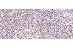 Immunohistochemistry of paraffin-embedded Human tonsil tissue using INPP5K Polyclonal Antibody at dilution of 1:90(x200) (INPP5K 抗体)