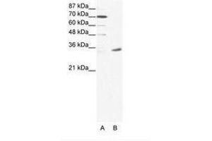 Image no. 1 for anti-Melanoma Antigen Family A, 9 (MAGEA9) (N-Term) antibody (ABIN202005) (MAGEA9 抗体  (N-Term))