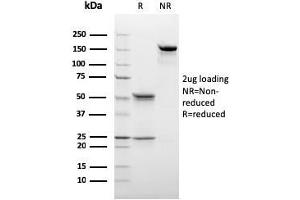 SDS-PAGE (SDS) image for anti-Complement Component 1, Q Subcomponent, B Chain (C1QB) (AA 41-188) antibody (ABIN6940772)