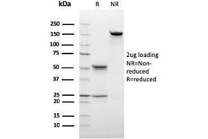 SDS-PAGE Analysis Purified C1QB Mouse Monoclonal Antibody (C1QB/2966). (C1QB 抗体  (AA 41-188))