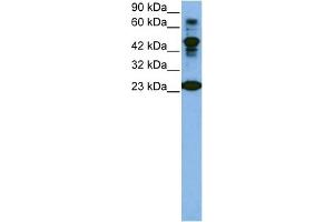 WB Suggested Anti-CDK2 Antibody Titration:  1 ug/ml  Positive Control:  Jurkat cell lysate CDK2 is strongly supported by BioGPS gene expression data to be expressed in Human Jurkat cells (CDK2 抗体  (C-Term))