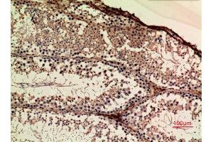 Immunohistochemistry (IHC) analysis of paraffin-embedded Mouse Ovary, antibody was diluted at 1:100.